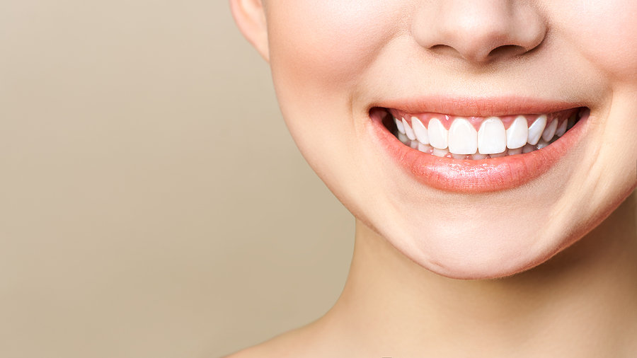 Teeth whitening, dentist dental office near me All smiles dental Vacaville CA